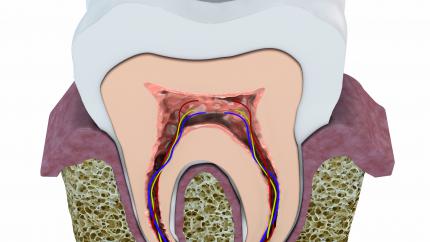 Dentina