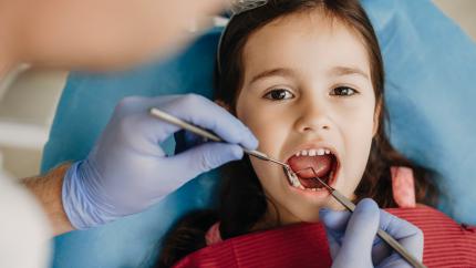 Ipomineralizzazione denti bambini