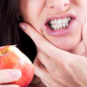 Denti trasparenti