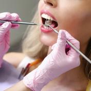 Erosione dentale