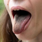 Lingua nera villosa