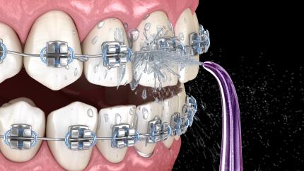 Idropulsore professionale