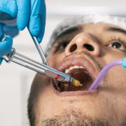 Anestesia dentale