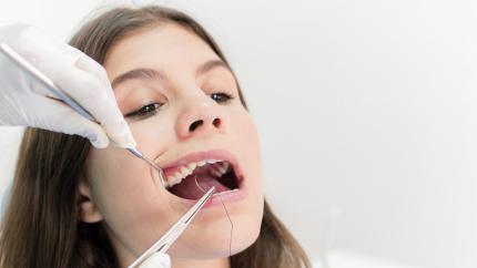Amalgama dentale