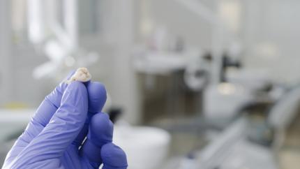Avulsione dentale