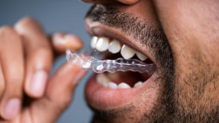 Che cos'è l'ortodonzia