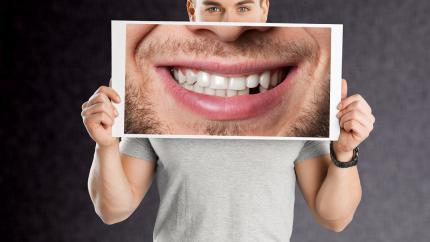 Come nascondere un dente rotto