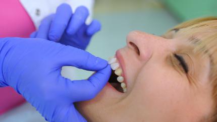 Copri denti