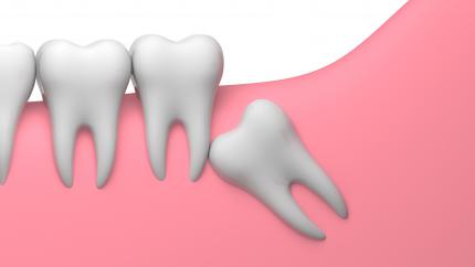 dente del giudizio