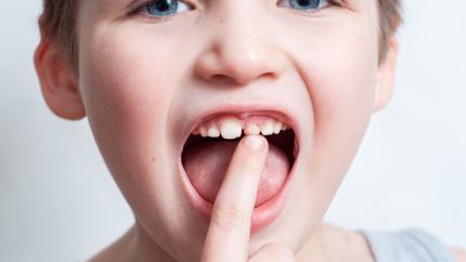 Denti incisivi