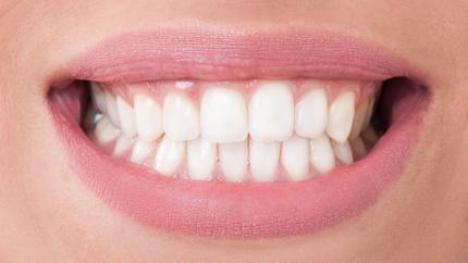 Denti perfetti