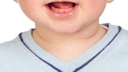 Dentizione neonati sintomi
