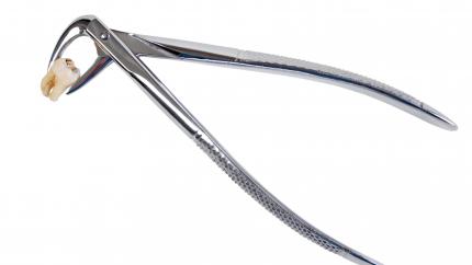 Estrazione dente con granuloma fa male
