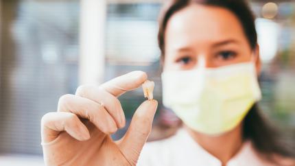 Estrazione dente con infezione sotto