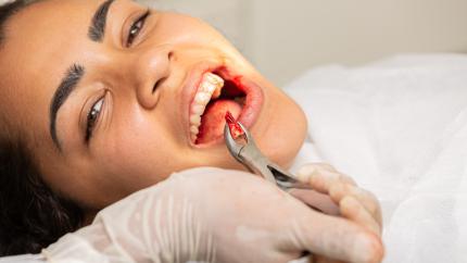 Punti dente del giudizio
