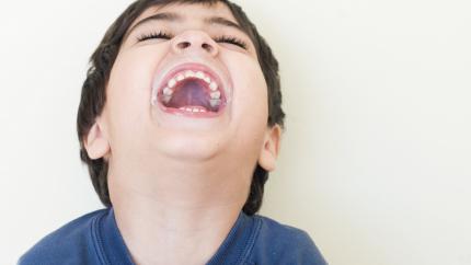 Quanti sono i denti da latte
