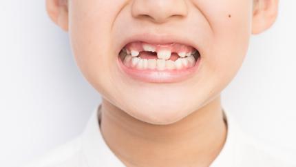 Schema caduta denti da latte