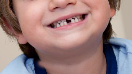 Topolino dei denti