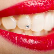 Brillantino al dente