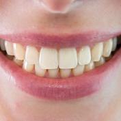 Denti rifatti