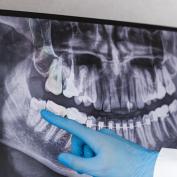 Punti dente del giudizio