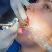 Quanto tempo impiega un dentino a spuntare