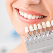 Scala colori denti