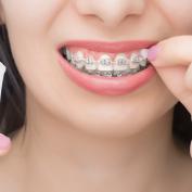 Silicone ortodontico