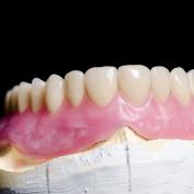 Zirconia dentale